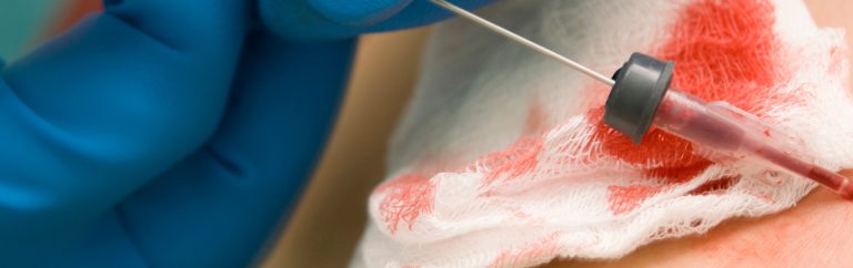 impacto-economico-das-infeccoes-de-corrente-sanguinea-como-as-UTIs-podem-reduzir-custos-e-salvar-vidas