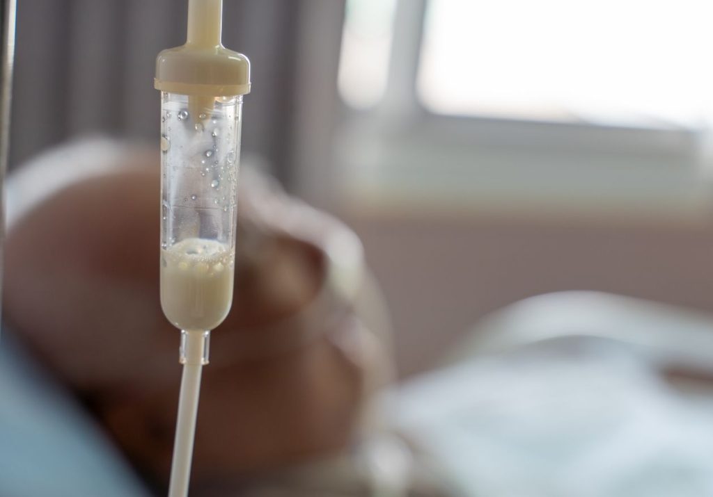 Alimentação pendurada em um suporte, conectada a um paciente em uma cama hospitalar. Curso: Dietoterapia.