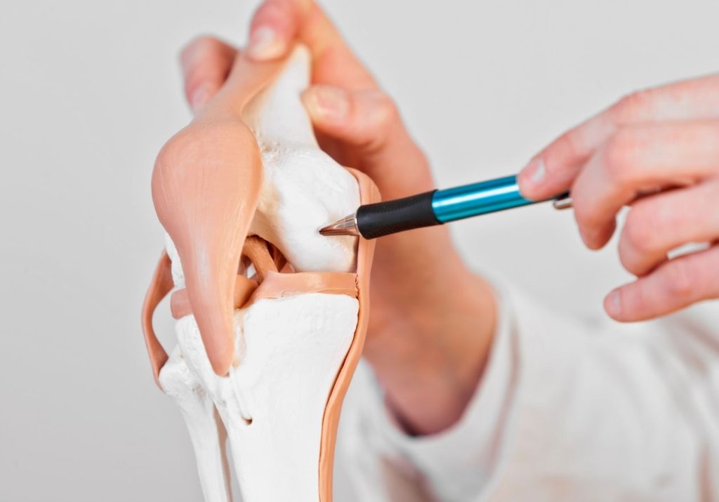 Mãos seguram um modelo anatômico de joelho, apontando detalhes com uma caneta. Curso: Medicina Regenerativa da Cartilagem.